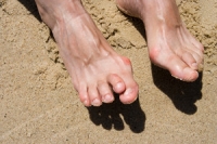Possible Causes of Hammertoes