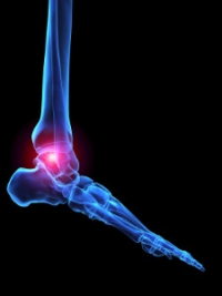 What Causes Rheumatoid Arthritis Pain?