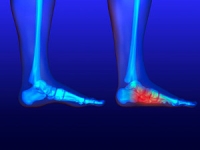 What Is There to Know About Flat Feet