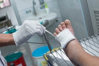 Wounds on the Feet May Lead to Foot Ulcers