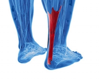 What are Achilles Tendon Injuries?
